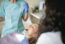 dental implants in Vancouver