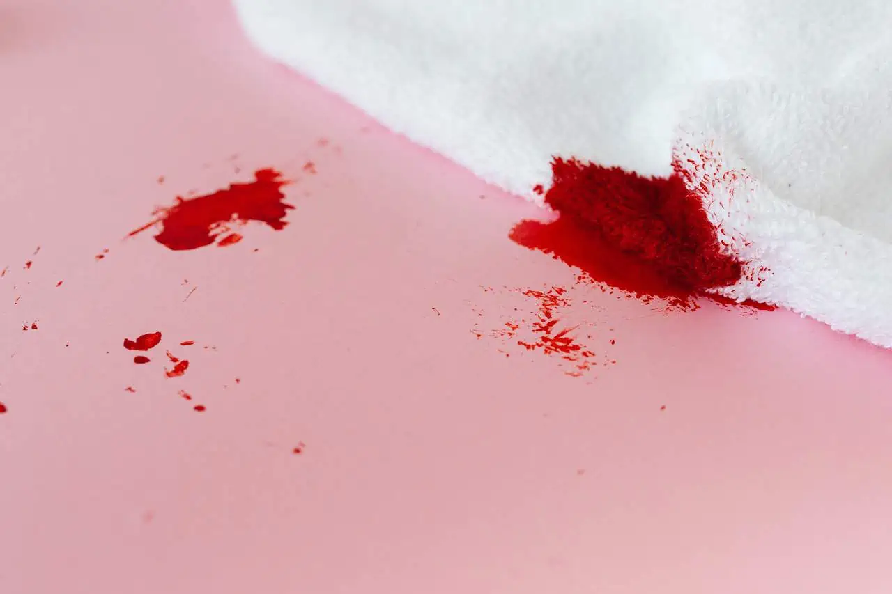 how to remove blood stains from clothes